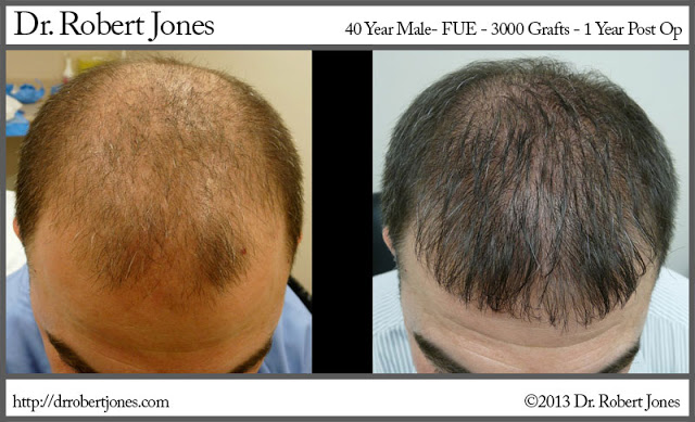 Fue Case Of A 40 Year Old Male