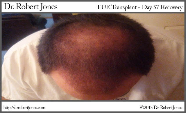 2013-4-19-fue-case-day-57