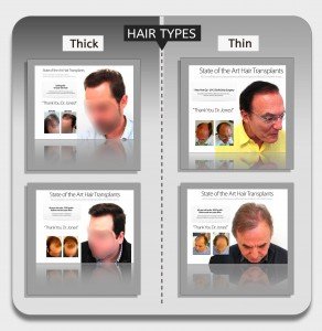 Hair Types FUE VS Strip 