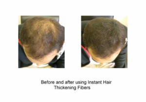 Before and After Using Instant Hair Thickening Fibers