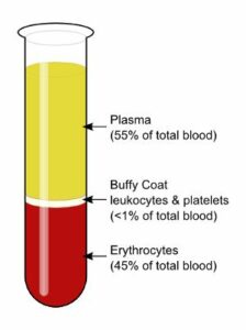 Platelet-Rich Plasma Injections for Hair loss