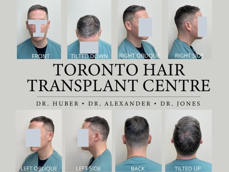 thtc - how to take photos for your virtual consult