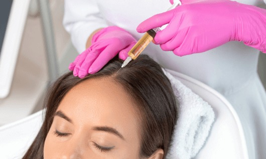Prp Treatment for Hair Loss