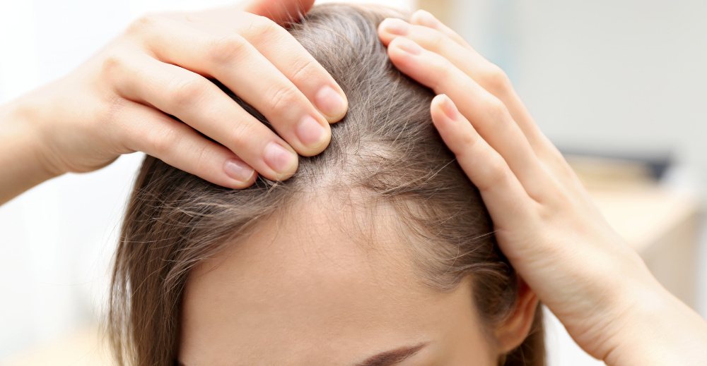 Treatment Options for Hair Loss in Women