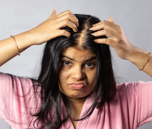 Types of Hair Loss in Women