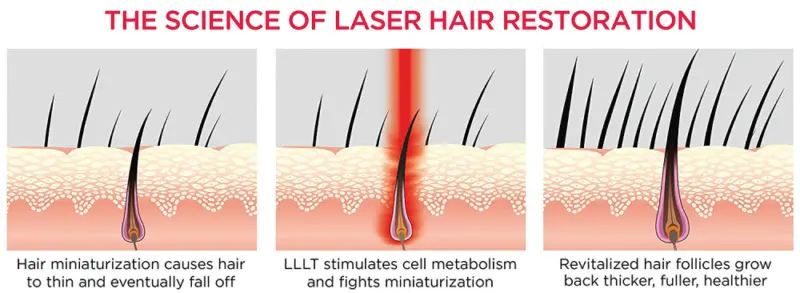 Biolight - The Science Of Laser Light Hair Restoration