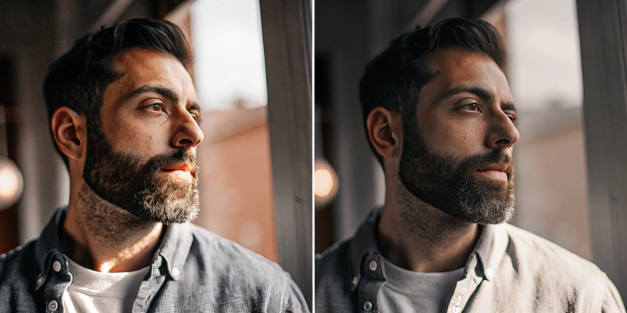 Beard Implants Before & After: Expectations vs. Reality