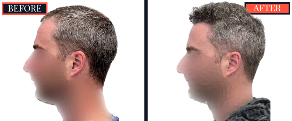 1773 G FUE RESULTS LEFT 16982-1