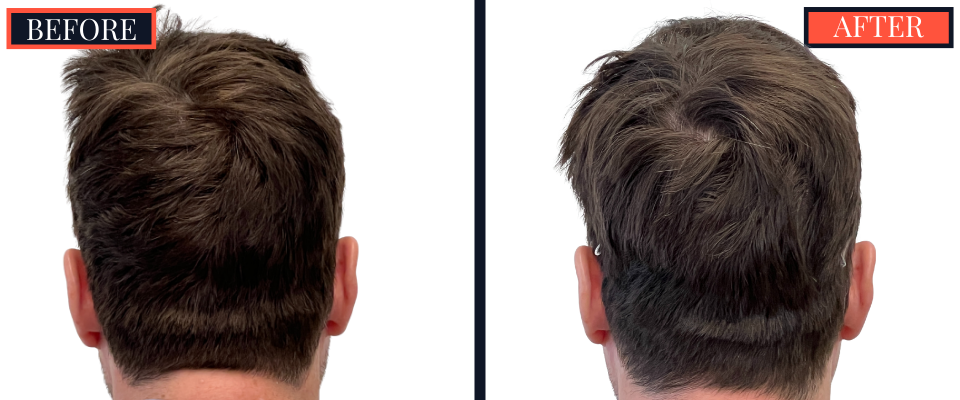 THTS Before and After Results - 1206 G FUE