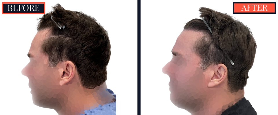 THTS Before and After Results - 1206 G FUE