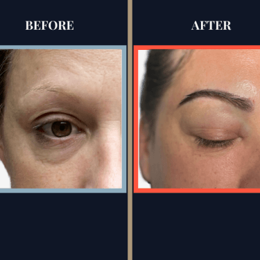 900-G-FUT-EYEBROW-FI-qzro685adfzym0ydb9ecfat8gfw4rydus7hppjwrja